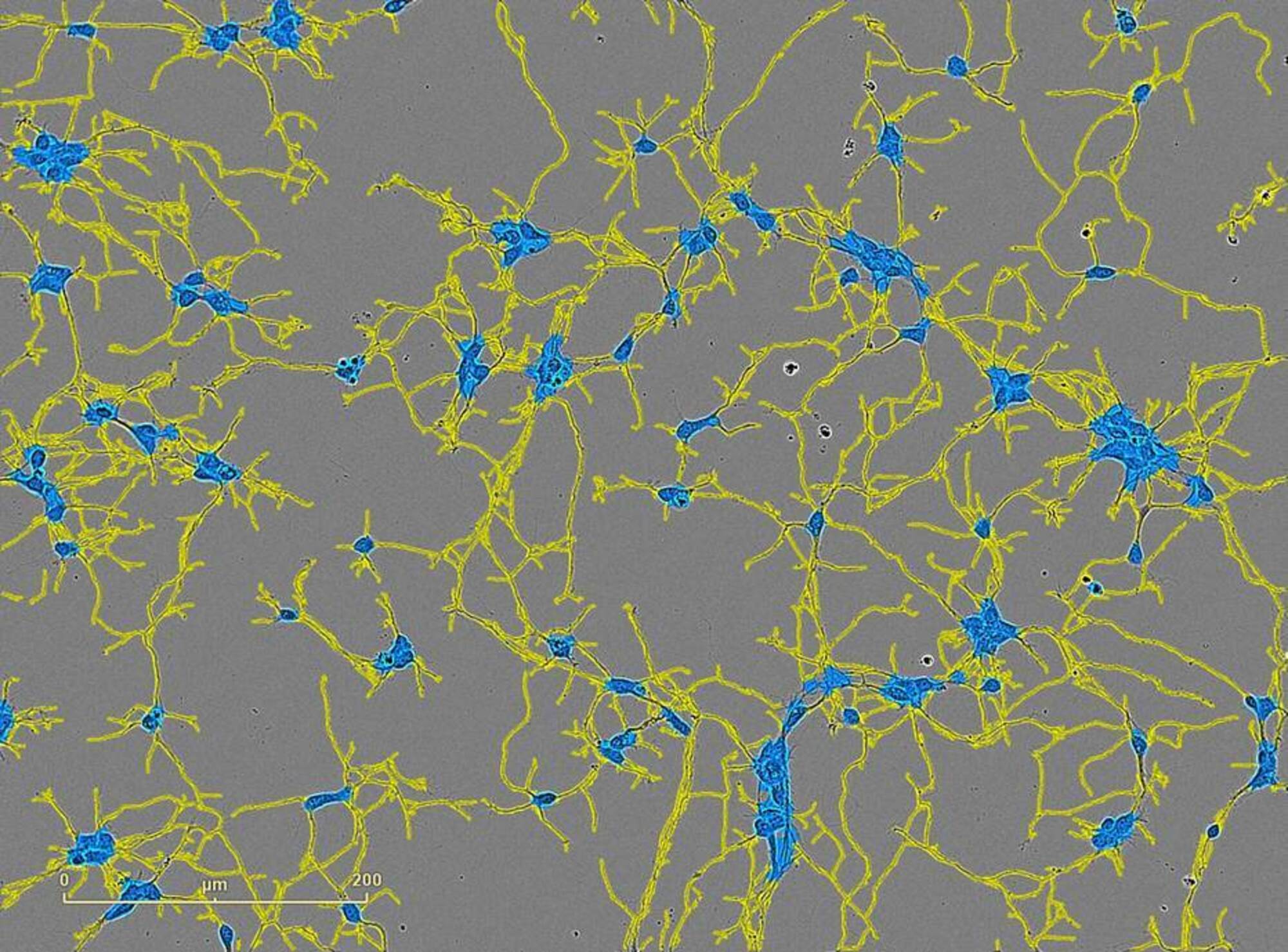 Incucyte® Neurotrack Analysis Software Module