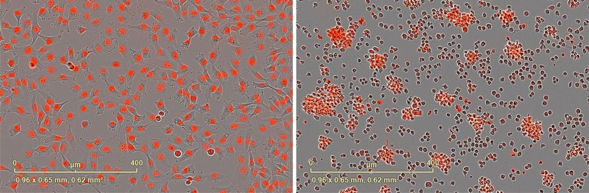 Incucyte® Nuclight Rapid Red Dye for Live-Cell Nuclear Labeling