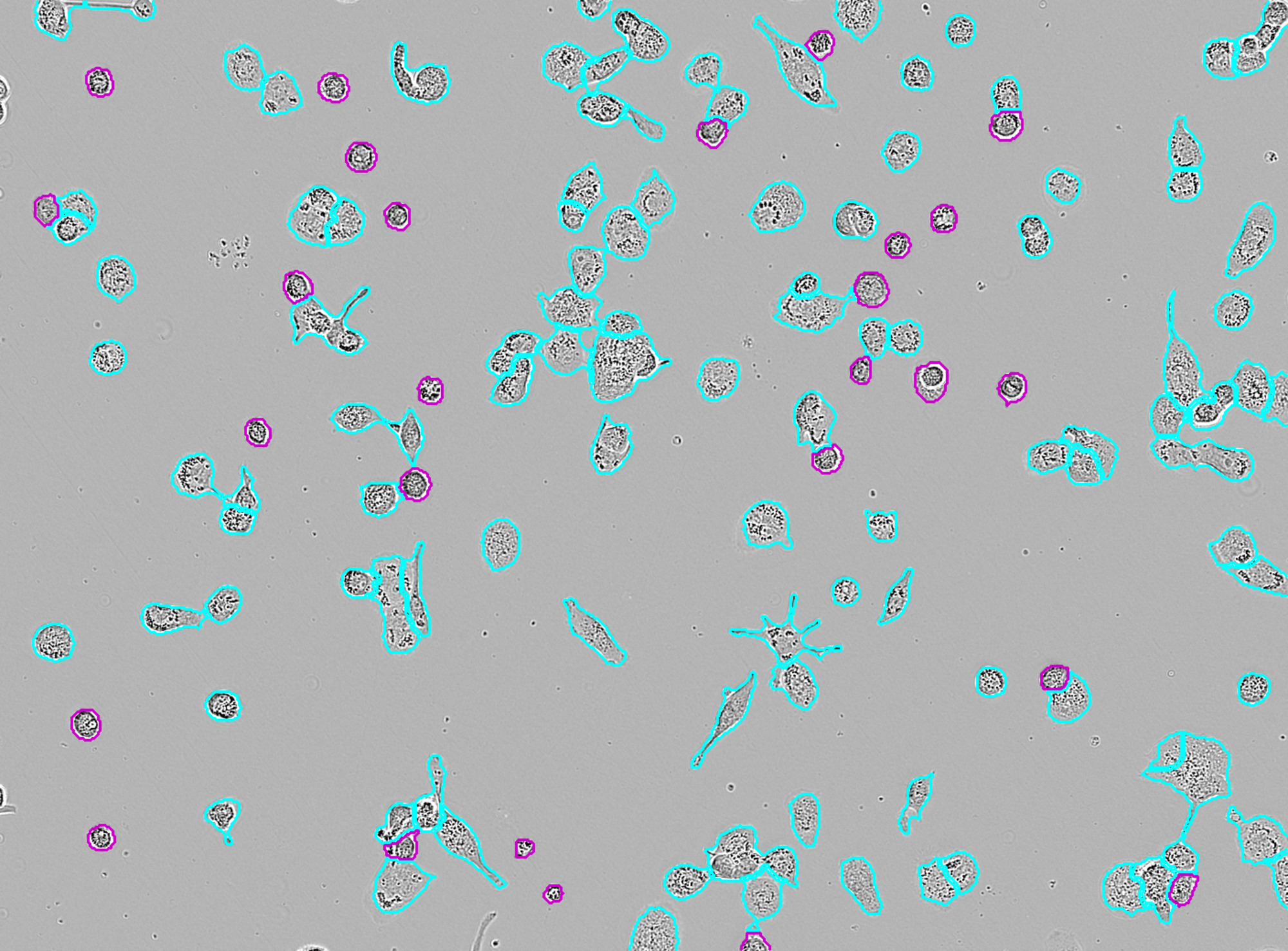 Incucyte® Advanced Label-Free Classification Analysis Software Module