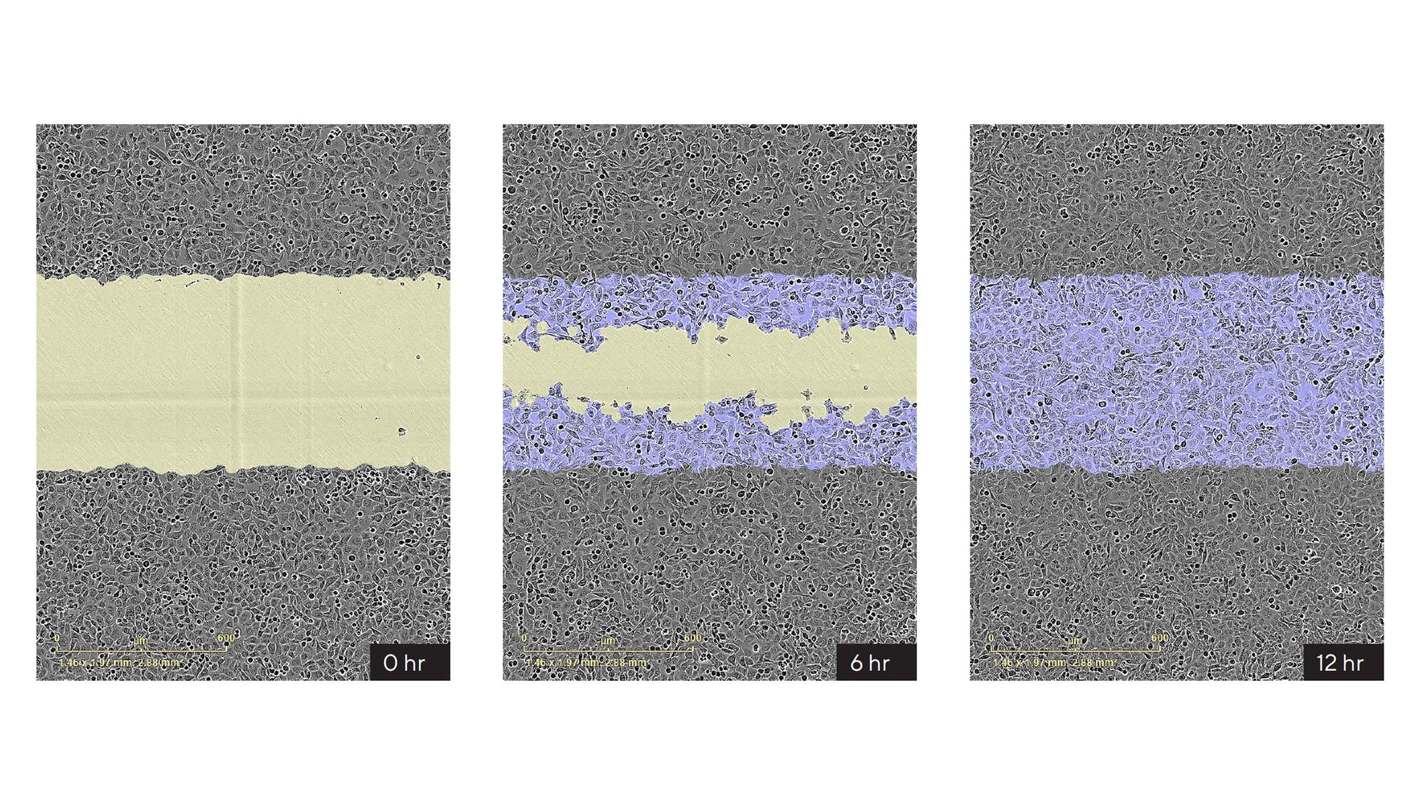 Incucyte® Scratch Wound Analysis Software Module