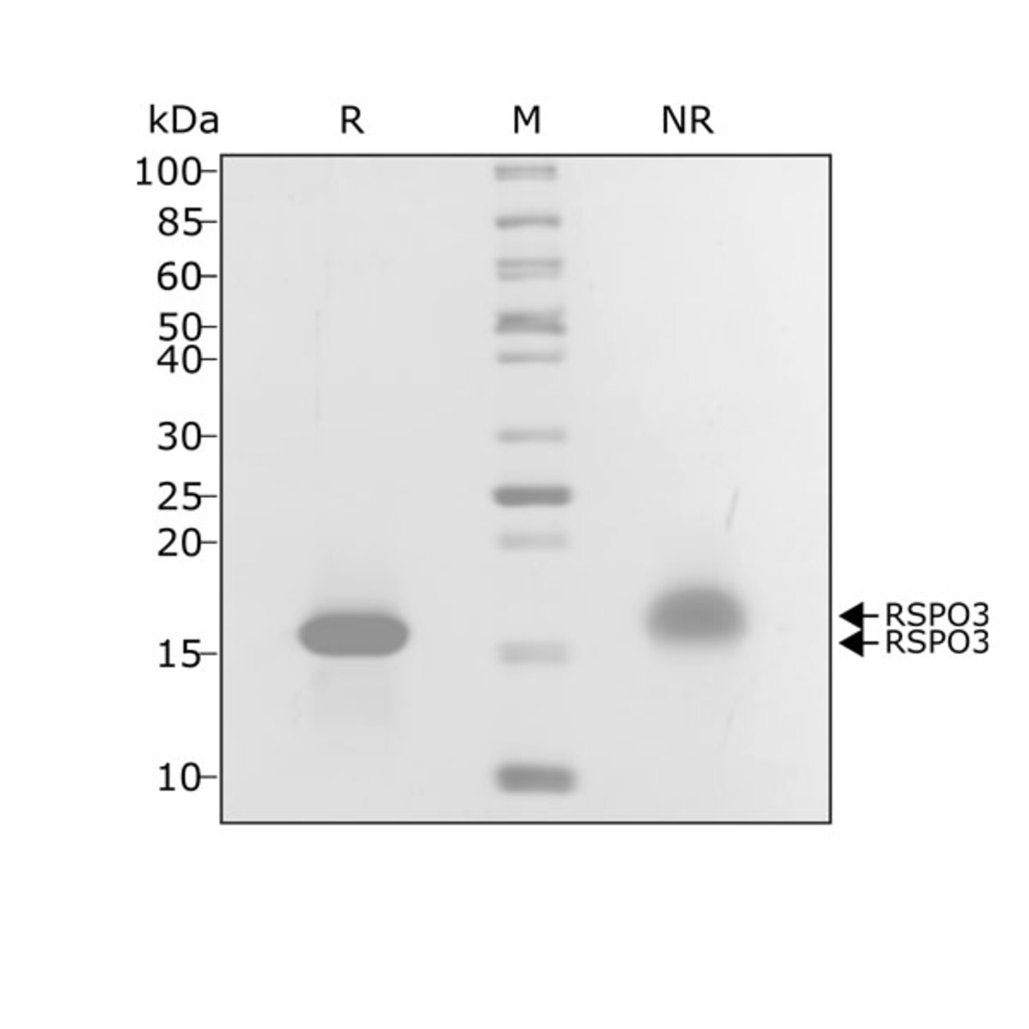 RUO Recombinant Human R-spondin 3 Protein