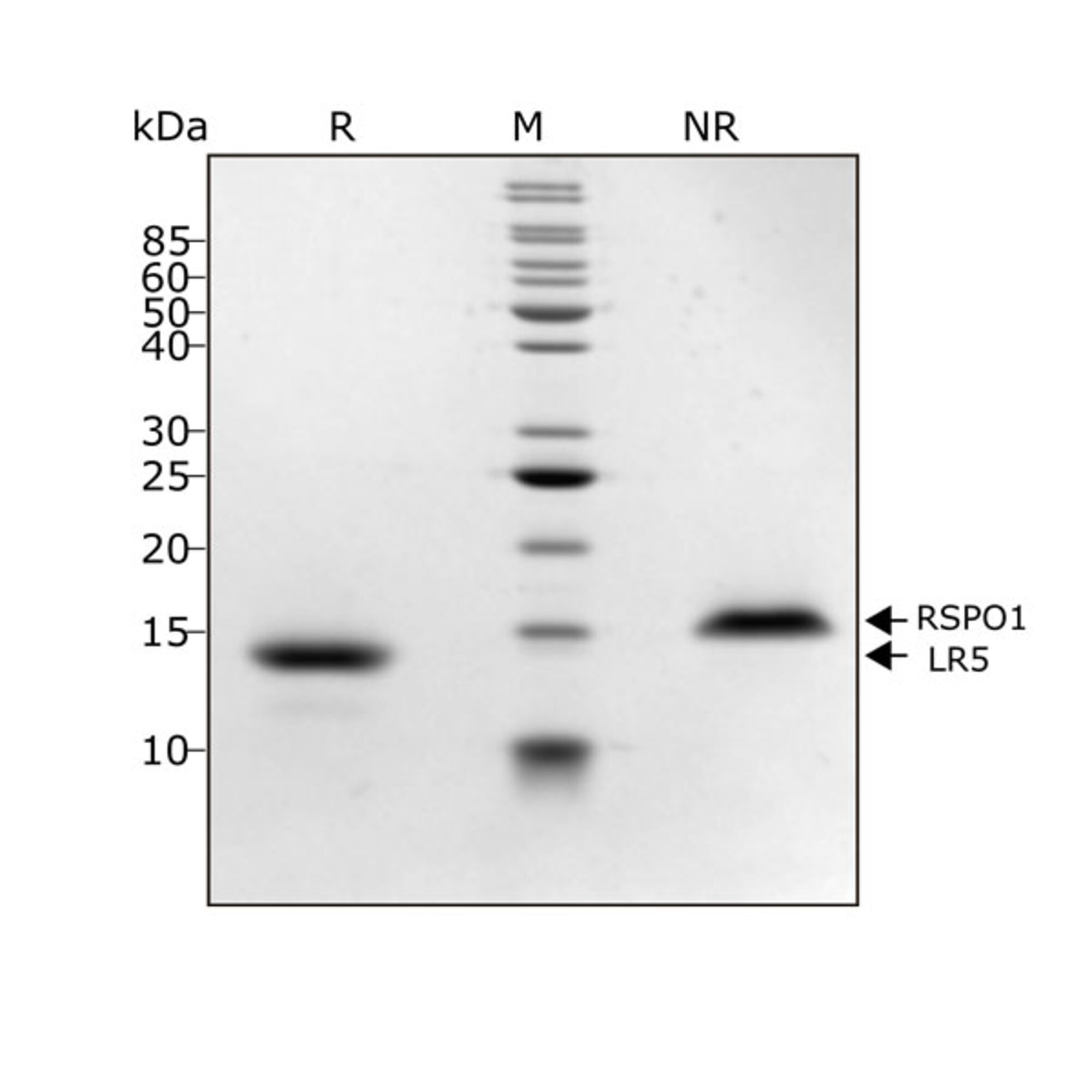 RUO Recombinant Human HGF (NK1) protein