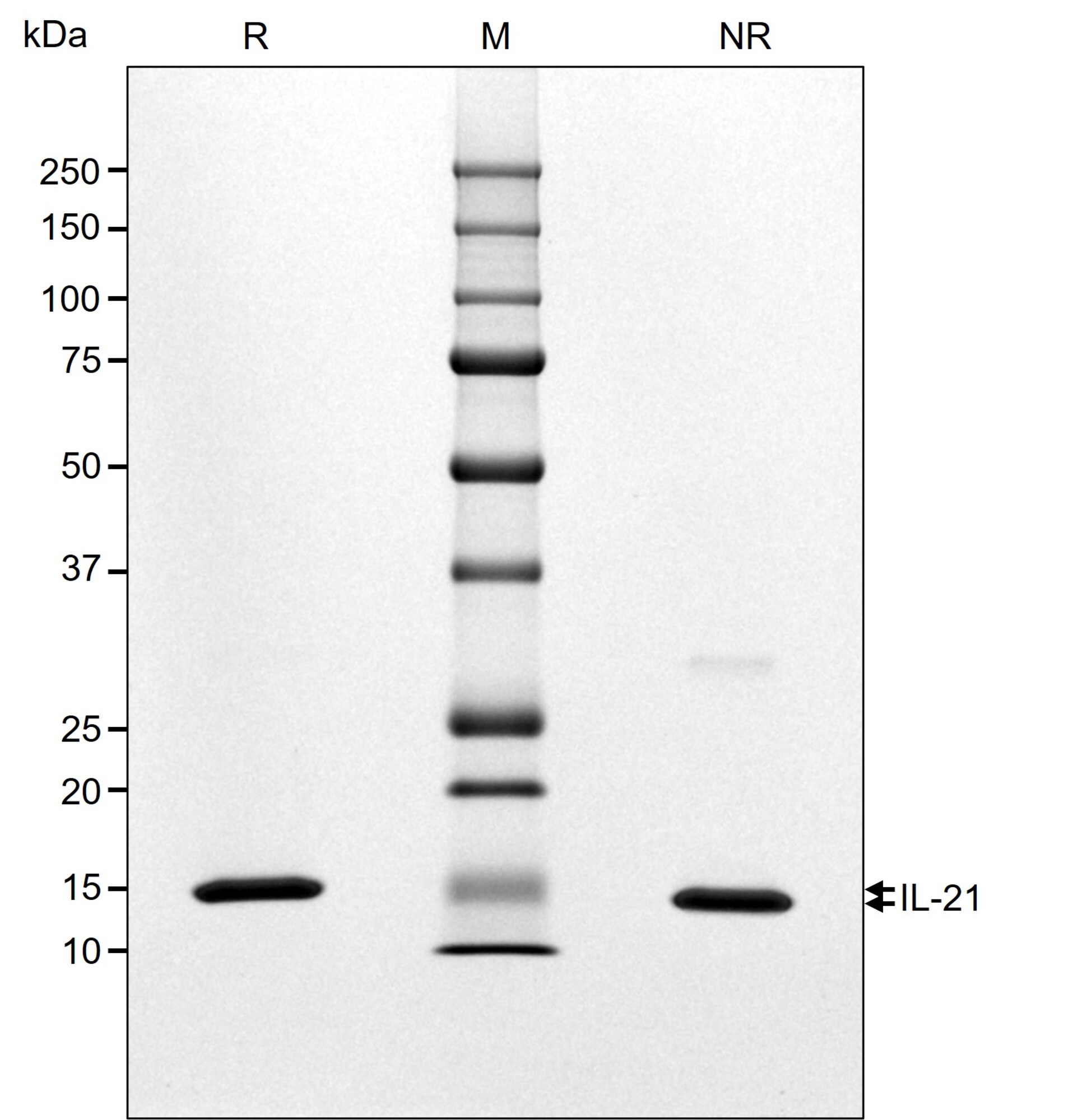 RUO Recombinant Human IL-21 Protein