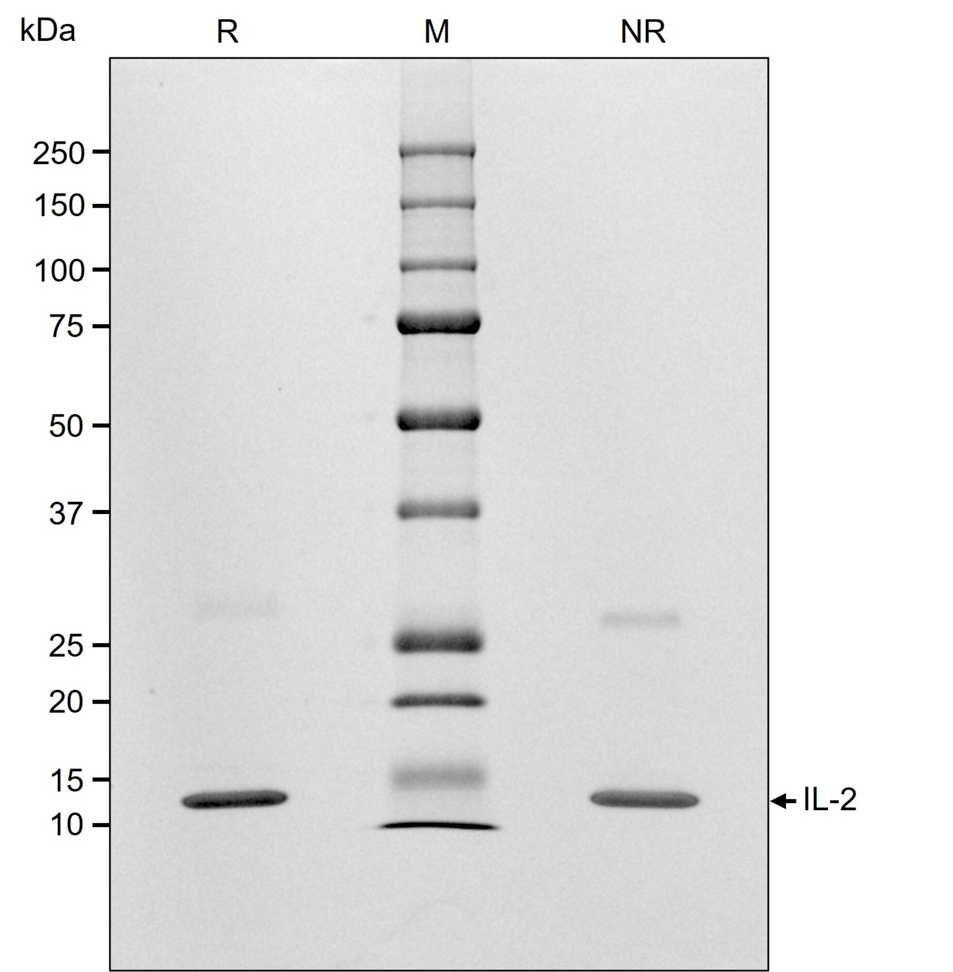 RUO Recombinant Human IL-2 Protein