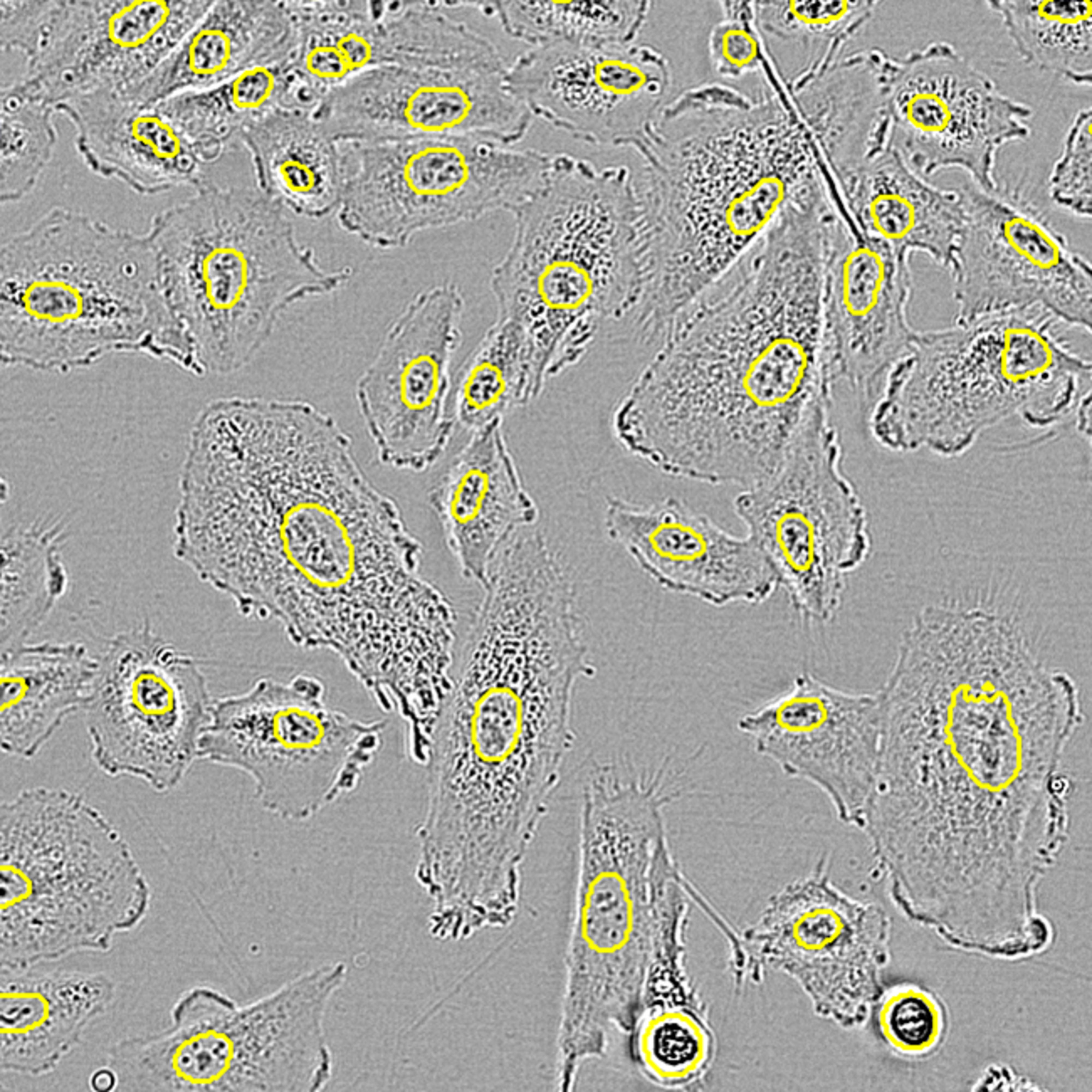 Incucyte® AI Nuclei Detection Software Module