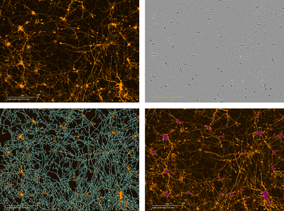 Incucyte® Neurotrack Analysis Software Module