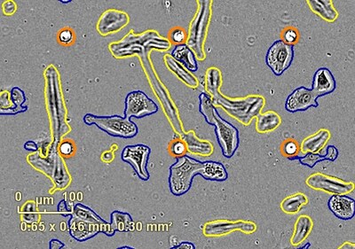 Incucyte® Chemotaxis Analysis Software Module