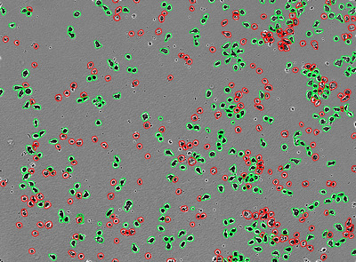 Incucyte® AI Cell Health Analysis Software Module