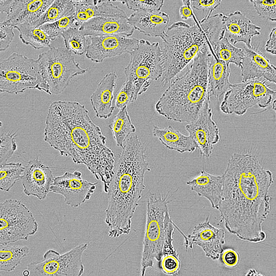 Incucyte® AI Nuclei Detection Software Module